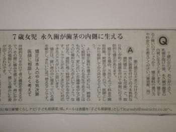 7歳　児永久歯が歯ぐきの内側に生える