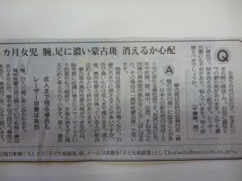 ５か月の女児　手足に蒙古班