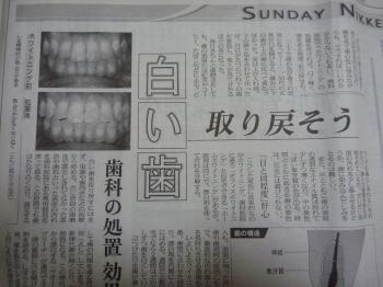 歯を明るくしましょう