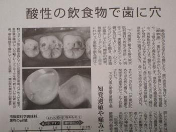 酸性の飲食物で歯に穴
