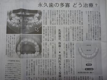 永久歯の歯の本数が違う