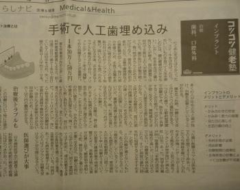 ｲﾝﾌﾟﾗﾝﾄについてー歯を失った方へ