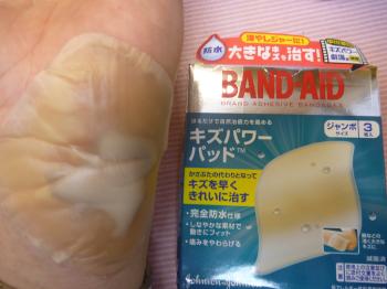 手を切っちゃいました