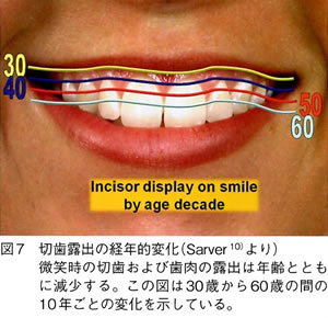 デーモンシステムによる矯正歯科治療